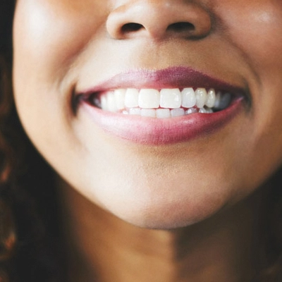 A woman showing off her beautiful smile