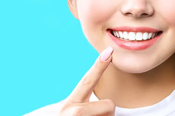 Woman with white teeth after whitening treatment at Avery Dental Center 