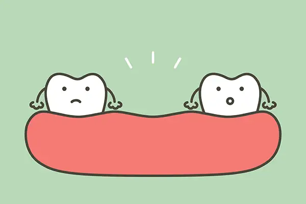 Two cartoon teeth in a gumline surprised by the gap between them, symbolizing tooth loss.