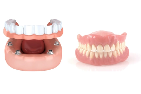 https://averydentalcenter.com/services/restorative-dentistry/implant-supported-dentures/ https://averydentalcenter.com/problems-with-snap-in-dentures/
